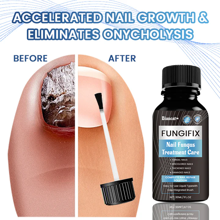 Biancat™ FungiFix Nagelpilz-Pflegefluid
