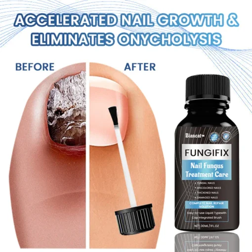 Biancat™ FungiFix Nagelpilz-Pflegefluid