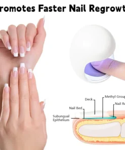 Biancat™ Nail Fungus Laser Cleaning Repair Device