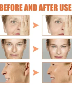 Botox Facial Essence