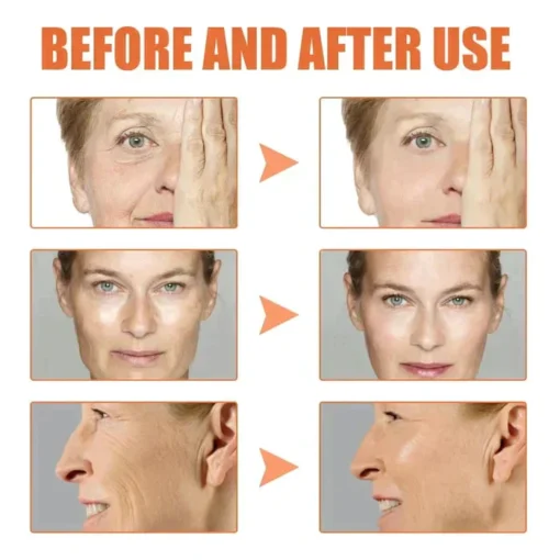 Botox Facial Essence