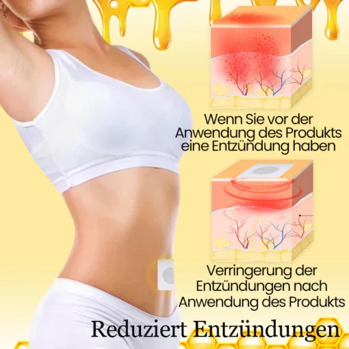 Ceoerty™ LymphTox Bienengift Entgiftungs- und Schlankheitspflaster