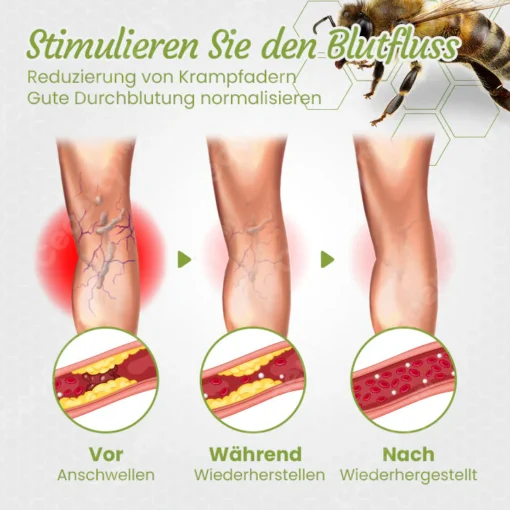 Ceoerty™ LymphaCare Bienengift-Einweichperlen