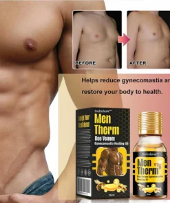 Dobshow™ MenTherm Bee Venom Gynecomastia Heating Oil