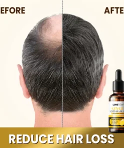 LIMETOW™ Anti-Hair Loss Treatment Essence