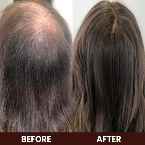 LIMETOW™ Veganic Hair Growth Oil - Image 8