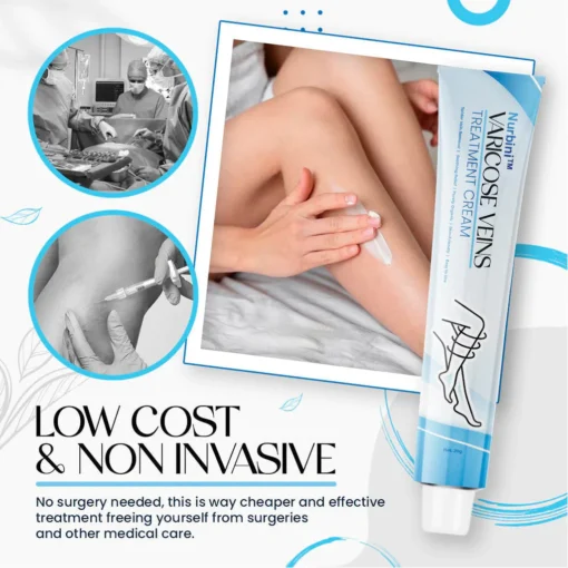 Nurbini™ Varicose Veins Treatment Cream