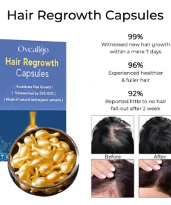 Oveallgo™ Hair Regrowth Capsules