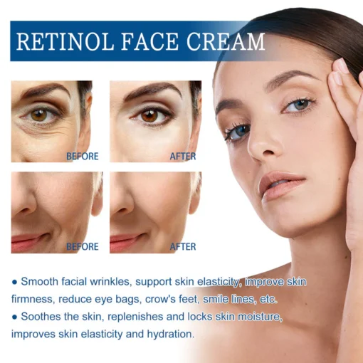 Seurico™ Anti-wrinkle Cream