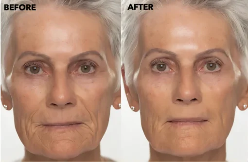 SkinRevive™ Facial Botox Serum