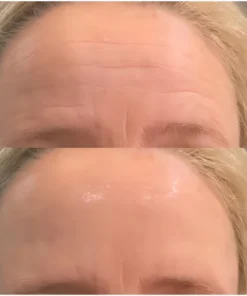 SkinRevive™ Facial Botox Serum