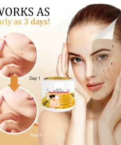 Tiword™ Bee Venom Mole and Wart Treatment Cream