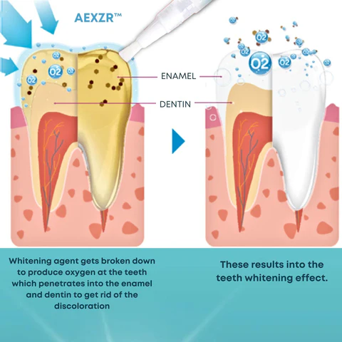 AEXZR™ Teeth Whitening Essence