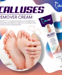 CallusPro™Calluses Remove Cream