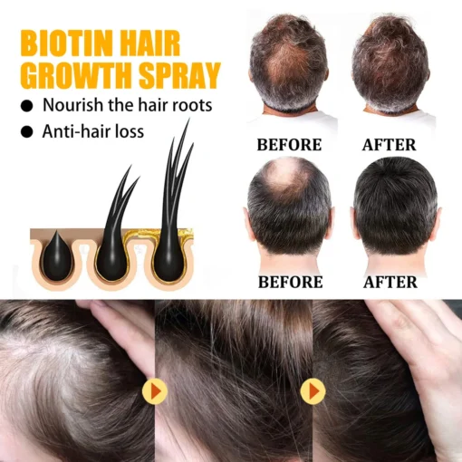 Dobshow™Biotin Premium Hair Growth Serum