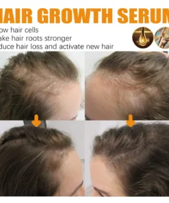 Dobshow™Biotin Premium Hair Growth Serum