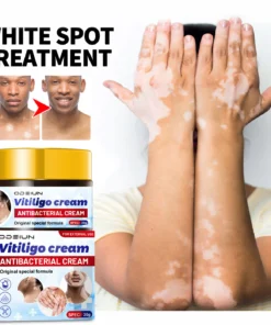 ODEIUN™ Vitiligo Cream