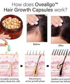 Oveallgo™ Hair Growth Capsules