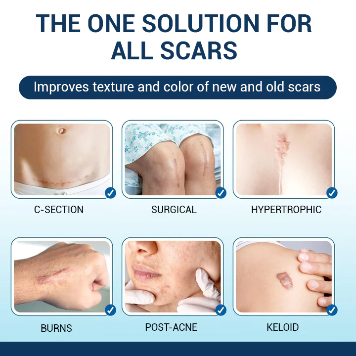 Oveallgo™ Silicone Scar Gel