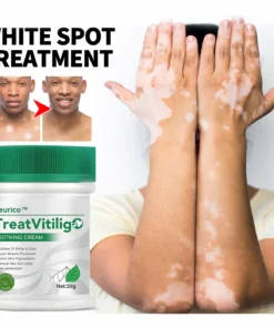 Seurico™ TreatVitiligo Soothing Cream