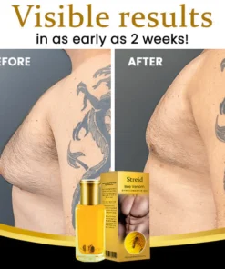 Streid™ Bee Venom Gynecomastia Oil