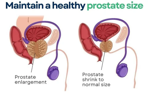 TRADITIONAL FRESHY Prostate Support Tea