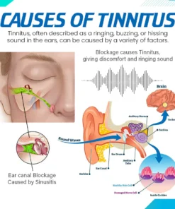 Tinnseal™ Goldenseal Ear Drop