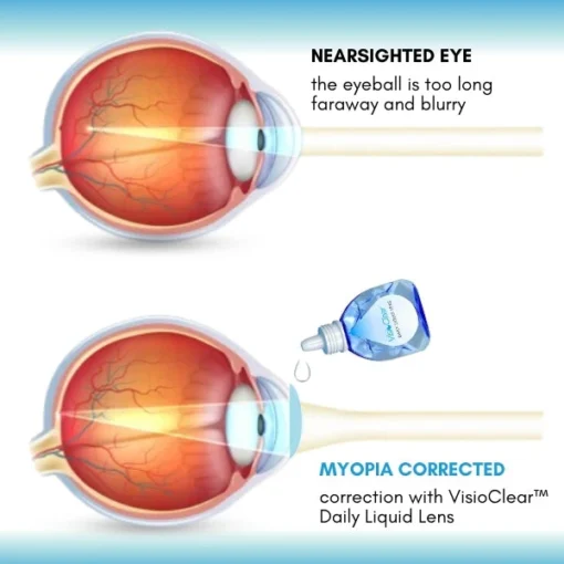 VisioClear™ Daily Liquid Lens