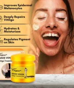 Vitiglow™ Snake Venom Vitiligo Treatment Cream