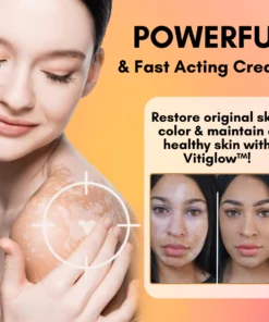 Vitiglow™ Snake Venom Vitiligo Treatment Cream