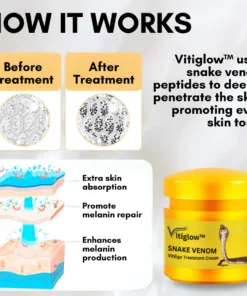 Vitiglow™ Snake Venom Vitiligo Treatment Cream