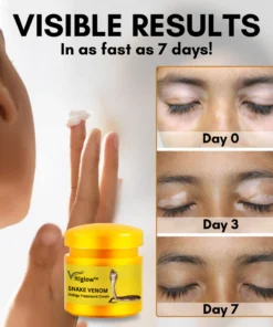 Vitiglow™ Snake Venom Vitiligo Treatment Cream