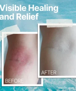 The Ocean Healed Eczema Soothing Cream