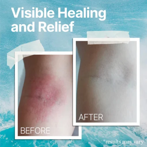 The Ocean Healed Eczema Soothing Cream