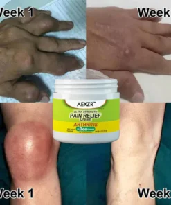 AEXZR™ Bee Venom Joint & Bone Therapy Cream