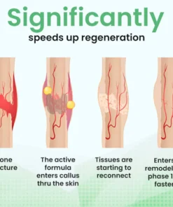 AEXZR™ Joints and Bone Therapy Plaster