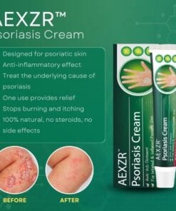 AEXZR™ Psoriasis Cream