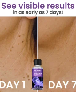 AEXZR™ Scyphozoa Skin Tags Solution