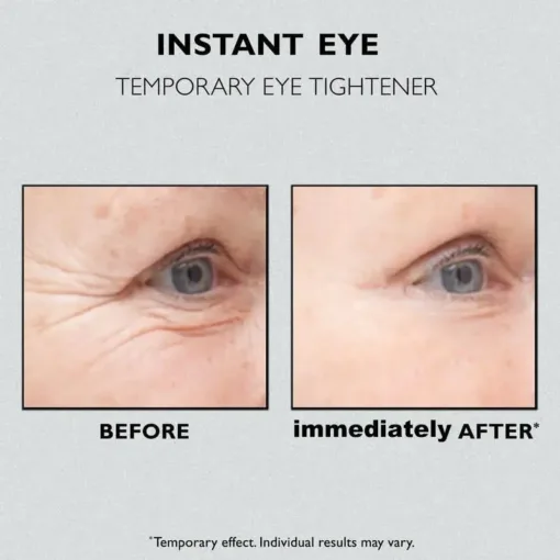 AQA™ Instant Eye Temporary Eye Tightener