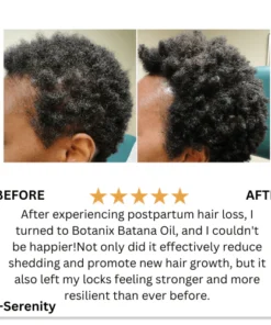 Batana Natural Hair Growth Oil