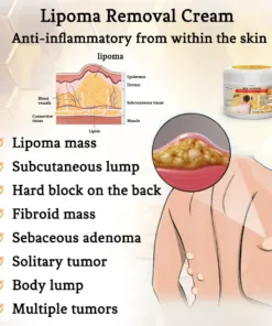 Bee Venom Lipoma Removal Cream