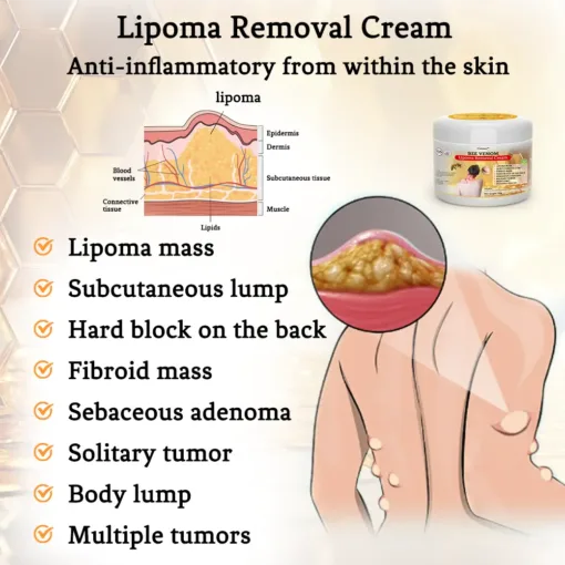 Bee Venom Lipoma Removal Cream