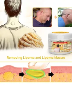 Bee Venom Lipoma Removal Cream