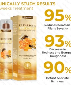 FLYCARE™ Cleartosis Bee Venom Keratosis Pilaris Spray