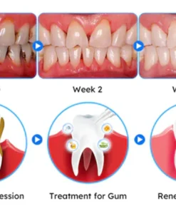 Fivfivgo™ Gum Therapy Gel - Upgraded formula for superior cleansing and repair