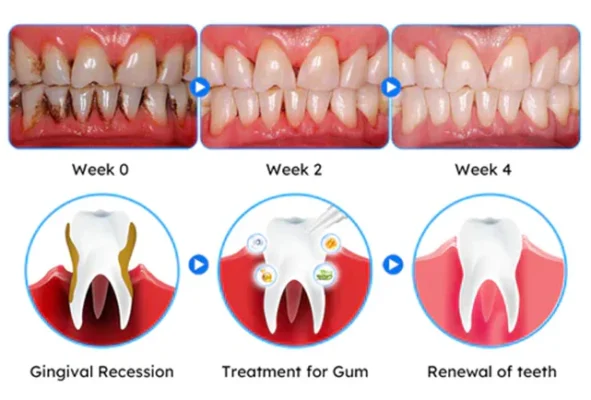 Fivfivgo™ Gum Therapy Gel - Upgraded formula for superior cleansing and repair