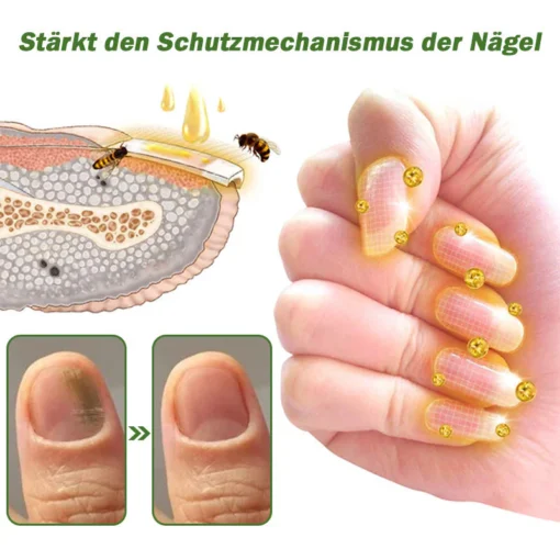 Furzero™ Nagelverteidigung Bienengift-Behandlungsserum