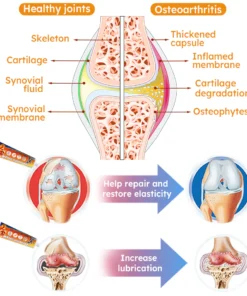 Furzero™ Turmeric Arthritis Cream