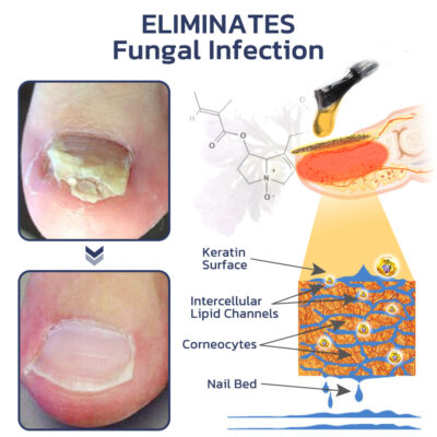 Fivfivgo™ Comfrey Healing 7 Day Nail Growth & Strengthening Serum