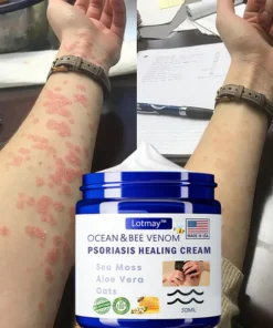 Lotmay™ Bee Venom & Ocean Psoriasis Healing Cream